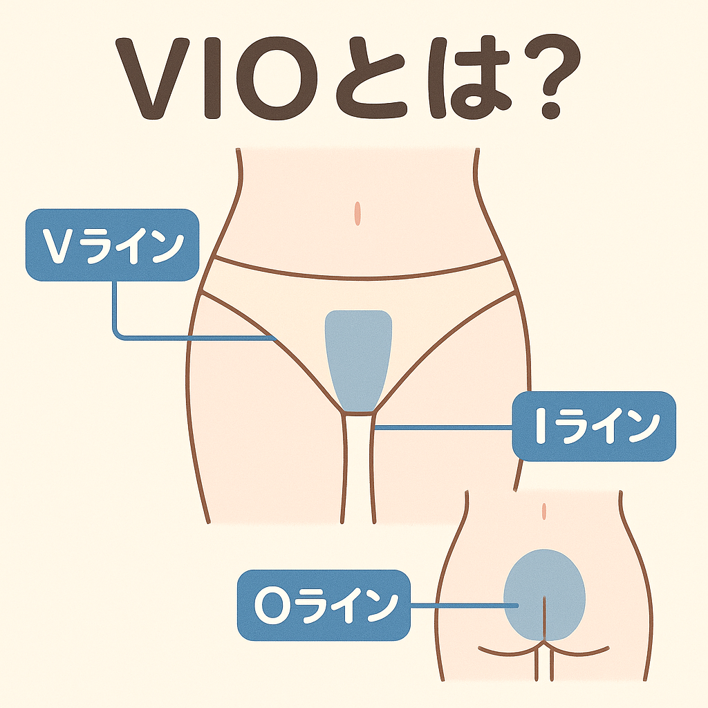 VIO脱毛エリア解説