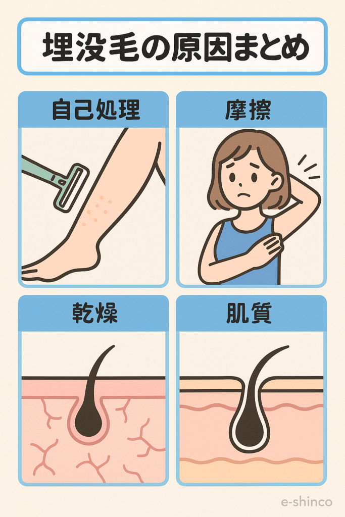 埋没毛の原因解説